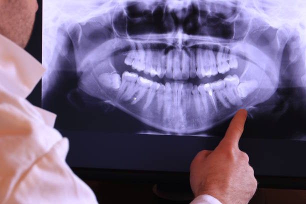 Best Chipped Tooth Repair Near Me  in Garrettsville, OH