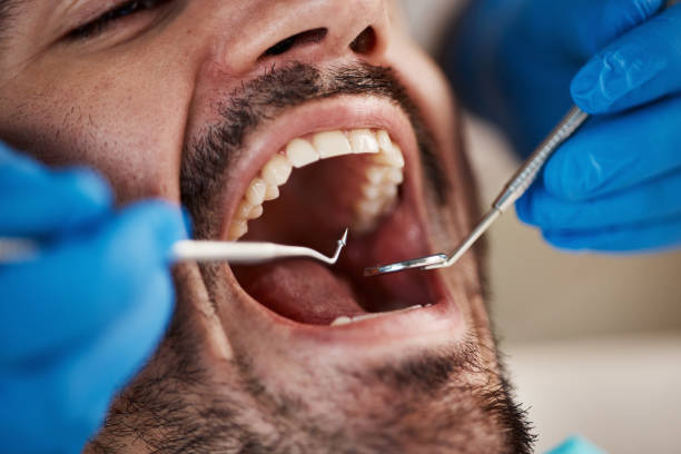 Best Emergency Tooth Extraction  in Garrettsville, OH