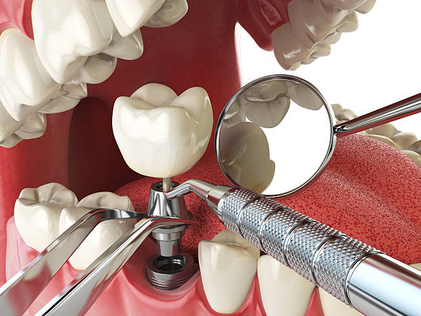 Best Emergency Dental Filling Replacement  in Garrettsville, OH